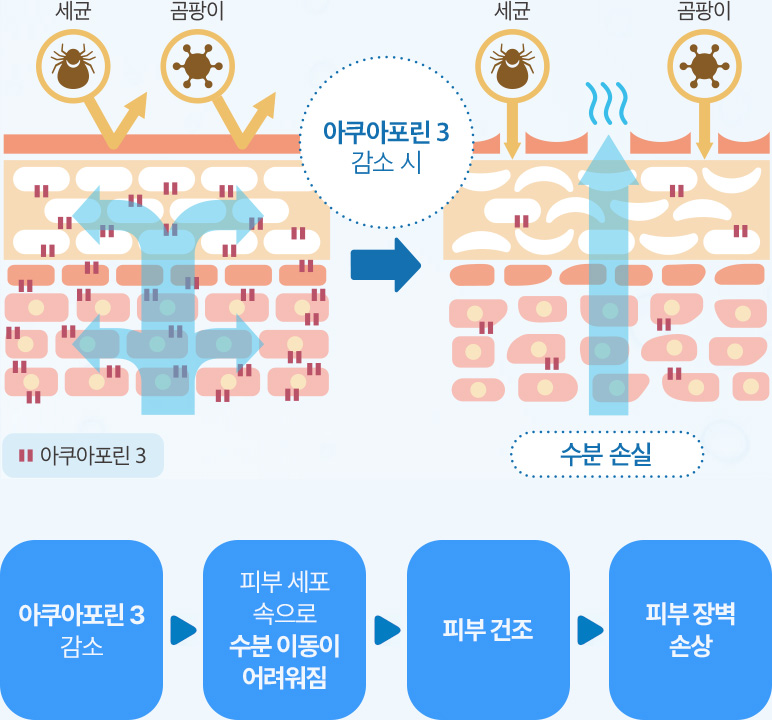 아쿠아포린 3 감소 > 피부 세포 속으로 수분 이동이 어려워짐 > 피부 건조 > 피부 장벽 손상