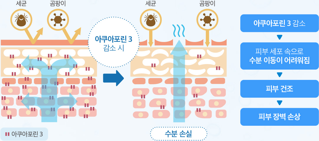 아쿠아포린 3 감소 > 피부 세포 속으로 수분 이동이 어려워짐 > 피부 건조 > 피부 장벽 손상