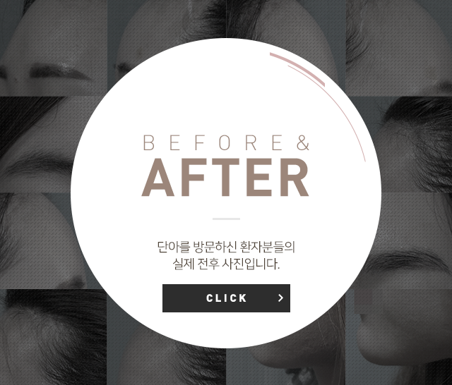 비포에프터 바로가기