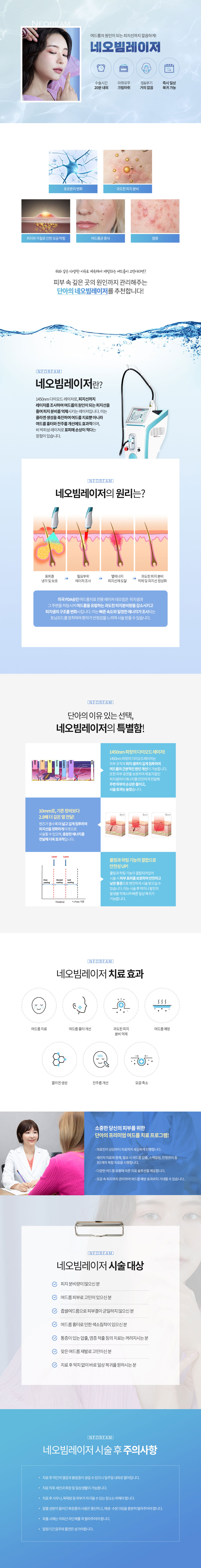 네오빔레이저
