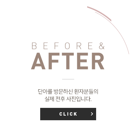 비포에프터